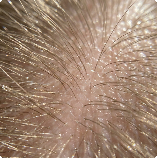 The Scalp Is Skin